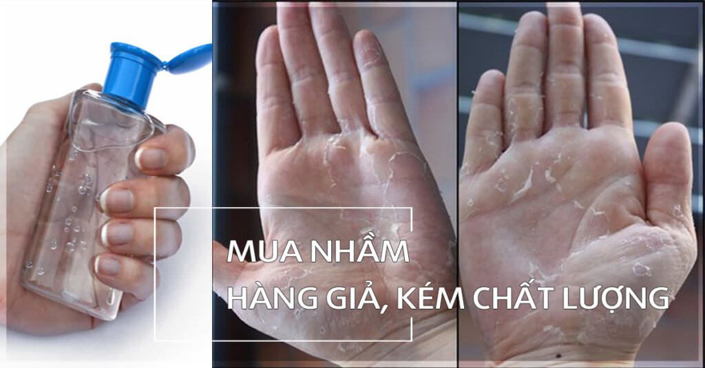 nước rửa tay kháng khuẩn khô giả kém chất lượng